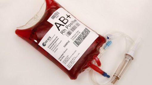 Reservas de sangue &quot;muito abaixo do recomendado&quot; - Federação de Dadores