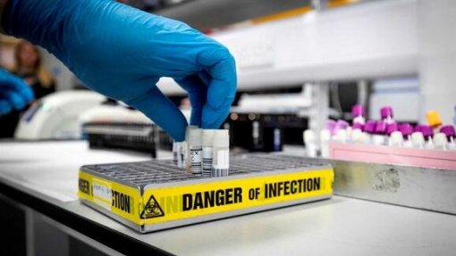 Covid-19: Triplicar testes pode evitar 900 hospitalizações e poupar milhões ao SNS - investigadores