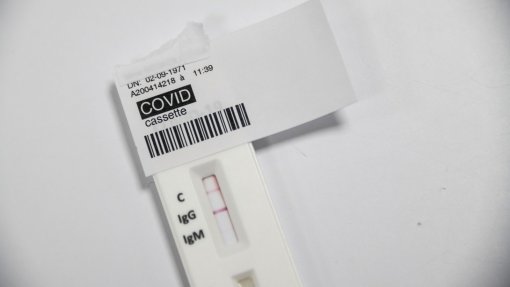 Covid-19: Fundação Champalimaud avança com testes serológicos a enfermeiros