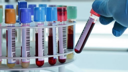 Laboratórios condenados por cartel nas análises clínicas e testes Covid