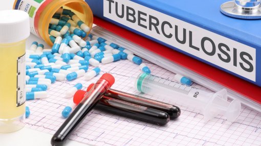 Tuberculose mata 1,2 milhões de pessoas em 2023 e ultrapassa a covid-19 – OMS