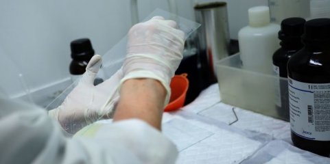 UA cria micropartículas com origem humana para aplicar na área da biomedicina